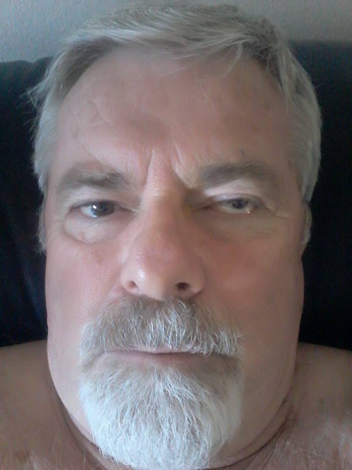 I had cataract surgery on my left eye today. I probably should have 